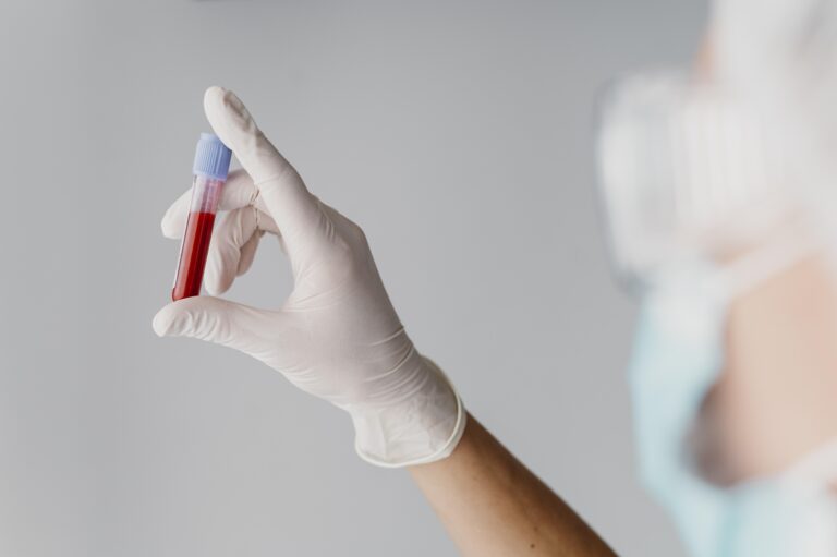 HIV e IST